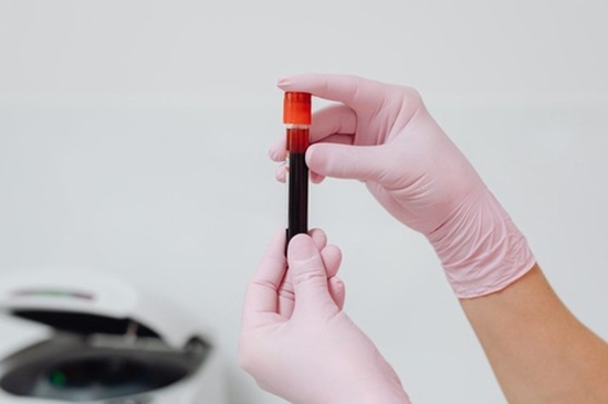 serum hemoglobin level and bone mineral density {faces}
